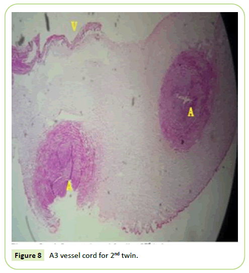 gynecology-obstetrics-twin