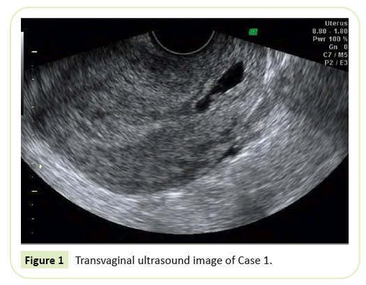 gynecology-obstetrics-ultrasound