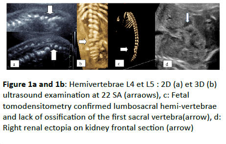 gynecology-obstetrics-ultrasound-examination