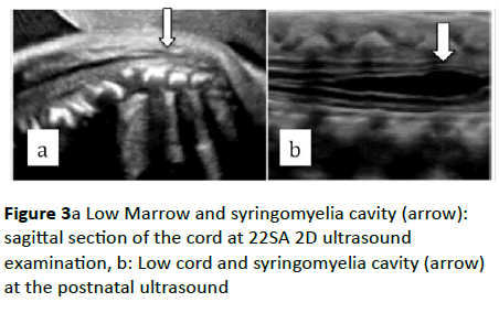 gynecology-obstetrics-ultrasound-examination