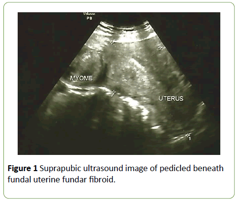 gynecology-obstetrics-ultrasound-image