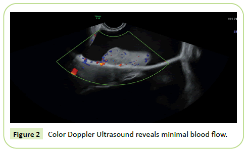 gynecology-obstetrics-ultrasound-reveals