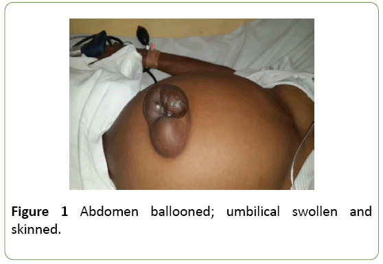 gynecology-obstetrics-umbilical-swollen
