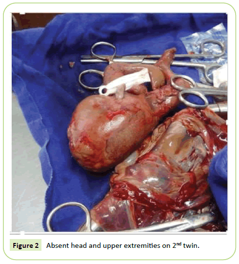 gynecology-obstetrics-upper-extremities