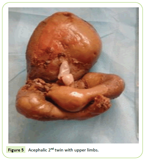 gynecology-obstetrics-upper-limbs