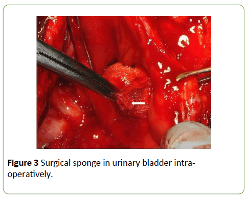 gynecology-obstetrics-urinary-bladder-intraoperatively