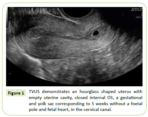 gynecology-obstetrics-uterine-cavity