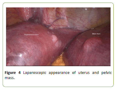 gynecology-obstetrics-uterus