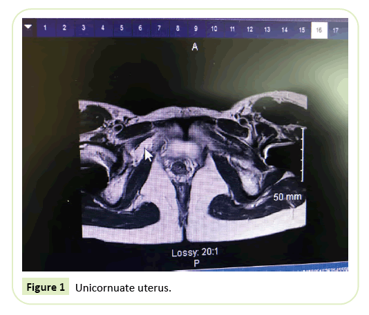 gynecology-obstetrics-uterus