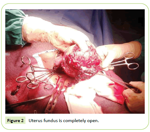 gynecology-obstetrics-uterus-fundus