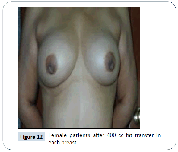 healthcare-communications-breast