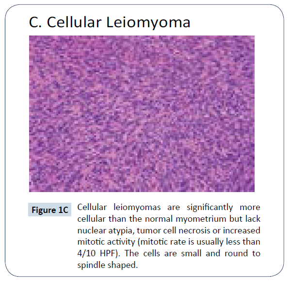 healthcare-communications-normal-myometrium