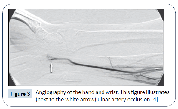 healthcare-communications-ulnar-artery