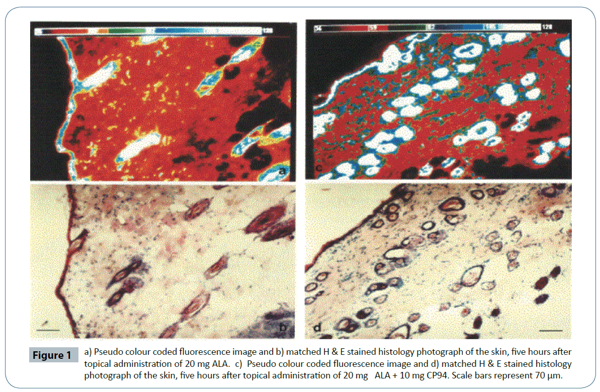 heavy-metal-toxicity-diseases-Pseudo-colour-coded