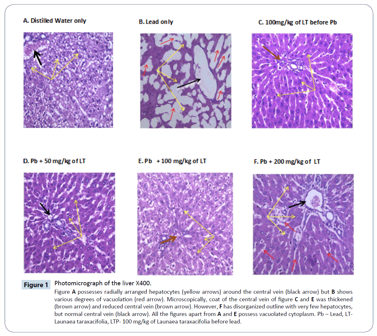 heavy-metal-toxicity-diseases-central-vein