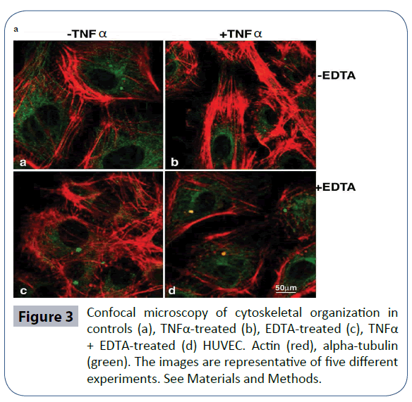 heavy-metal-toxicity-diseases-cytoskeletal-organization