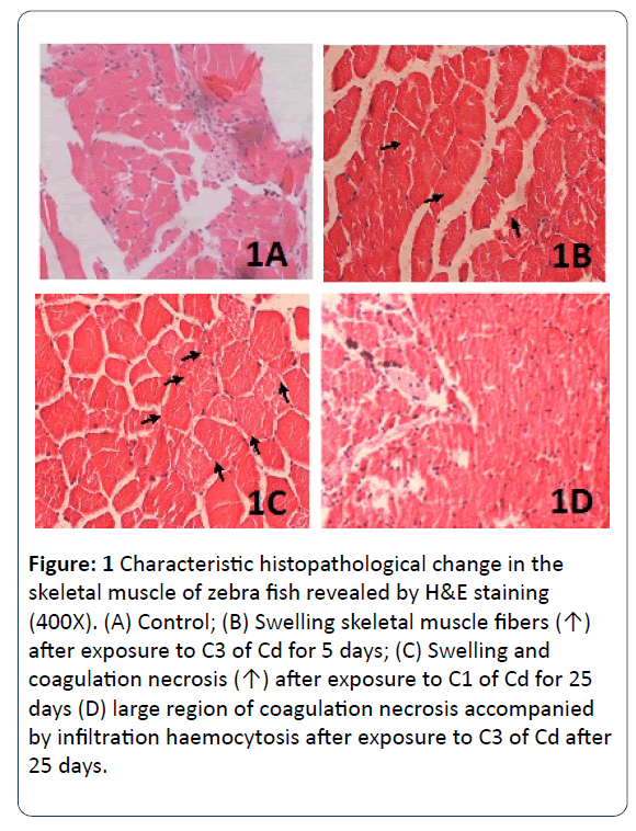 heavy-metal-toxicity-diseases-infiltration-haemocytosis