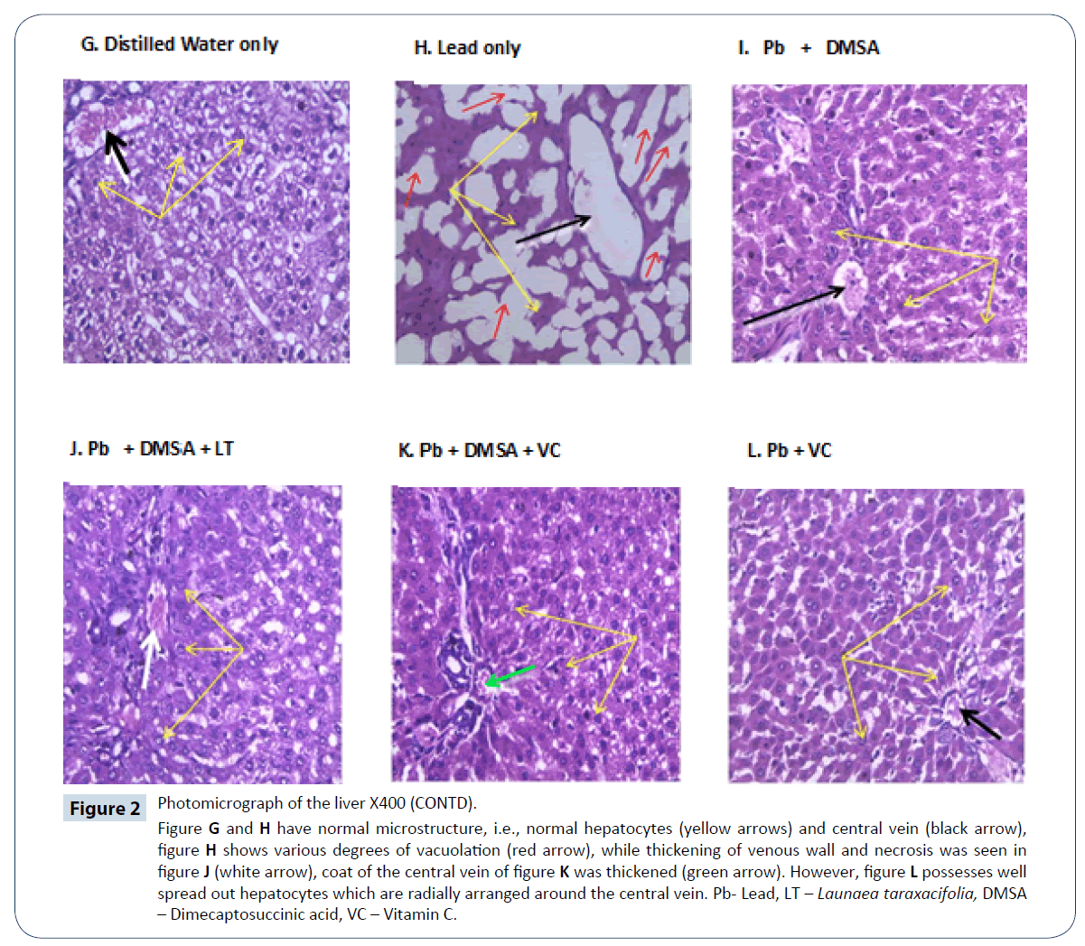 heavy-metal-toxicity-diseases-normal-microstructure