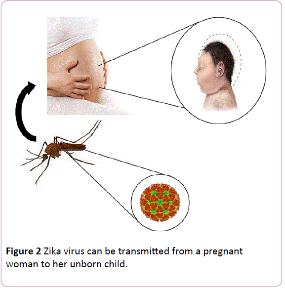 infectioncontrol-Zika-virus