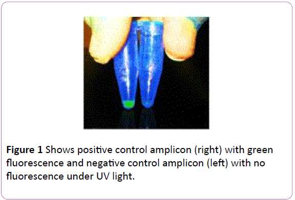 infectioncontrol-control-amplicon