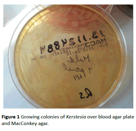 infectious-diseases-and-treatment-Growing-colonies