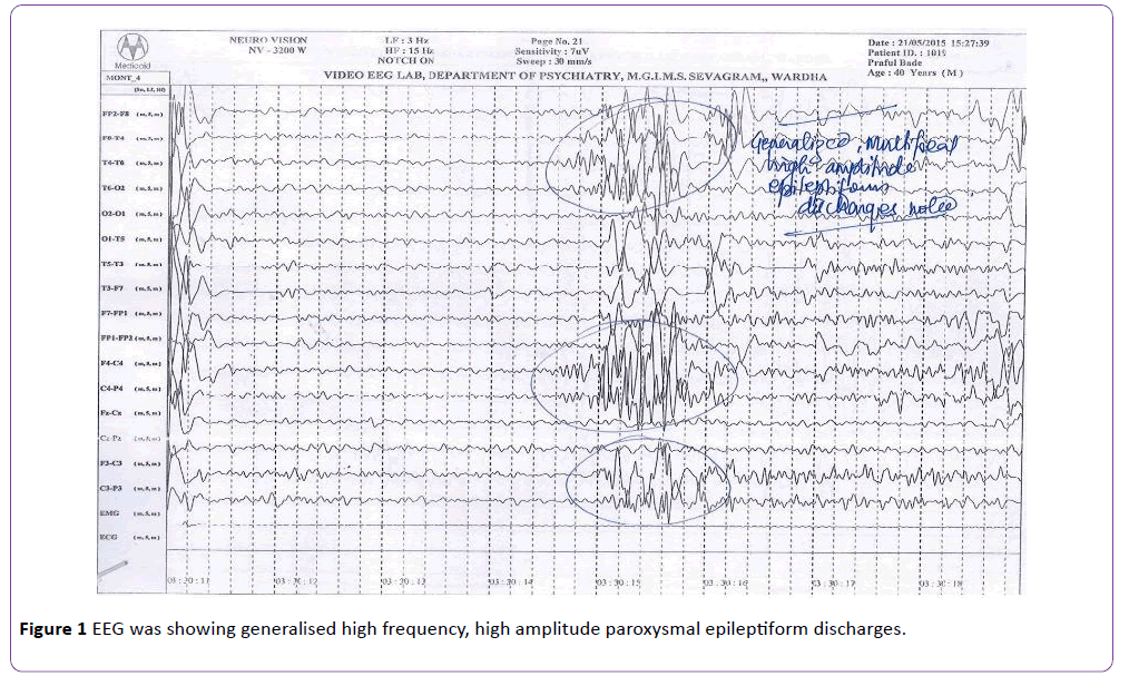 insights-in-pharma-research-generalised-high-frequency