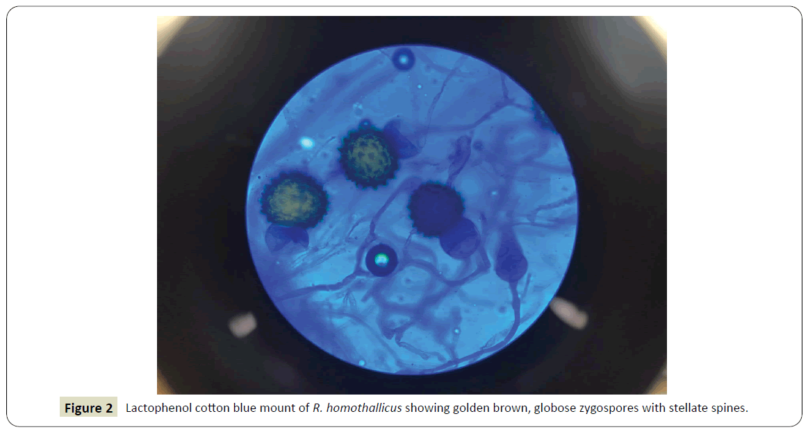intensive-critical-care-globose-zygospores