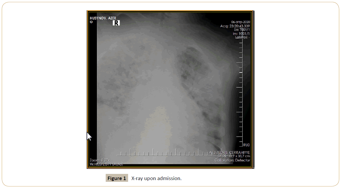 intensive-critical-care-upon-admission
