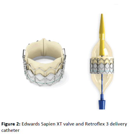 interventional-cardiology-Edwards-Sapien