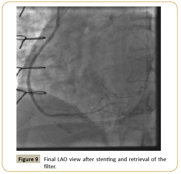 interventional-cardiology-Final-LAO