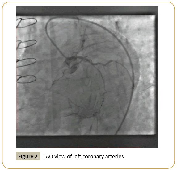 interventional-cardiology-LAO-view