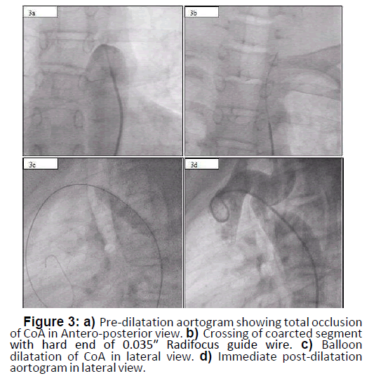 interventional-cardiology-antero-posterior-7-6-133-g003
