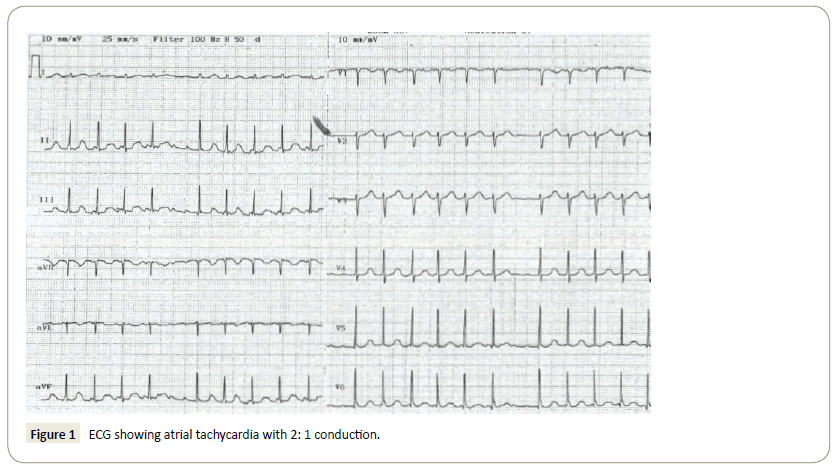 interventional-cardiology-atrial