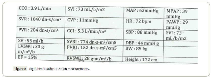 interventional-cardiology-catheterization