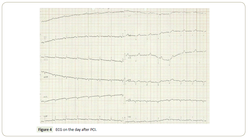 interventional-cardiology-day-