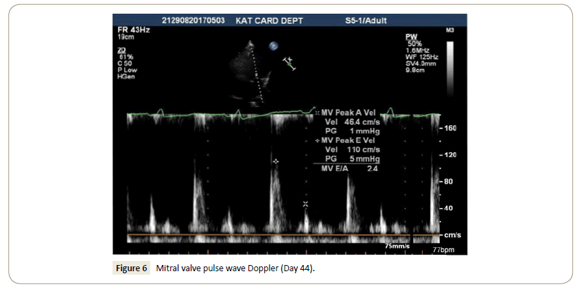 interventional-cardiology-doppler