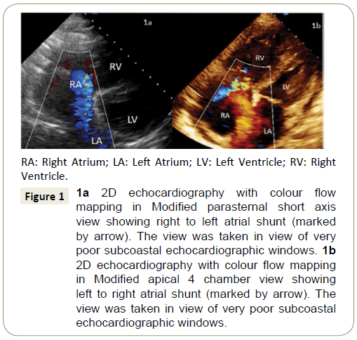 interventional-cardiology-echocardiography