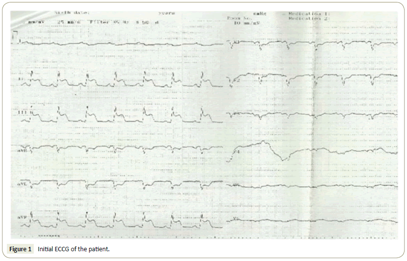 interventional-cardiology-patient