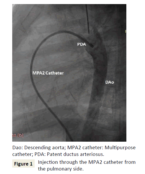 interventional-cardiology-pulmonary-side