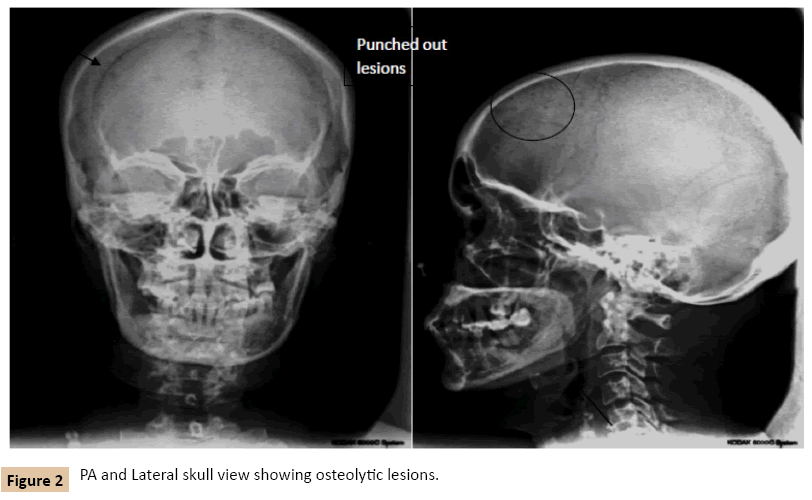 journal-oral-medicine-lesions