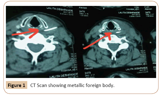 journal-oral-medicine-metallic