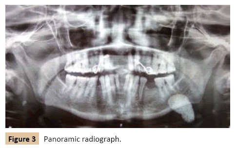 journal-oral-medicine-radiograph