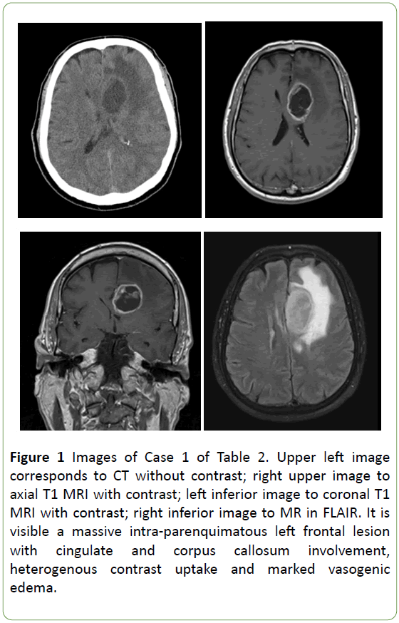 neuro-oncology-neuroscience-inferior-image