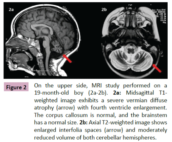 neurooncology-weighted-image-exhibits