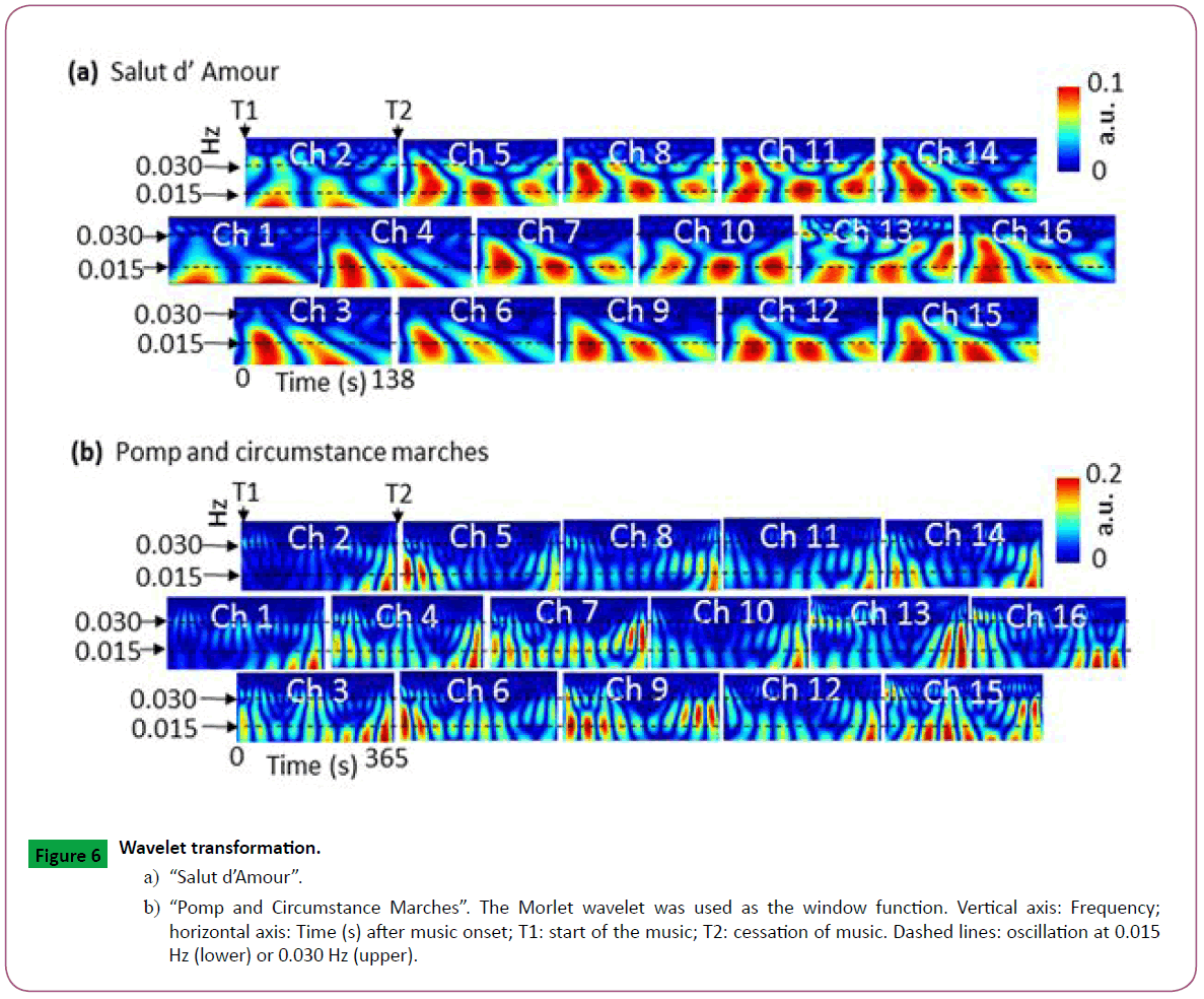 neurosciences-Wavelet-transformation