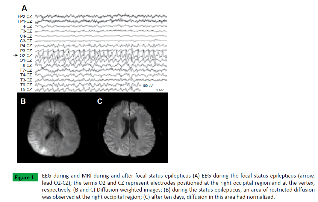 neurosciences-brain-imaging