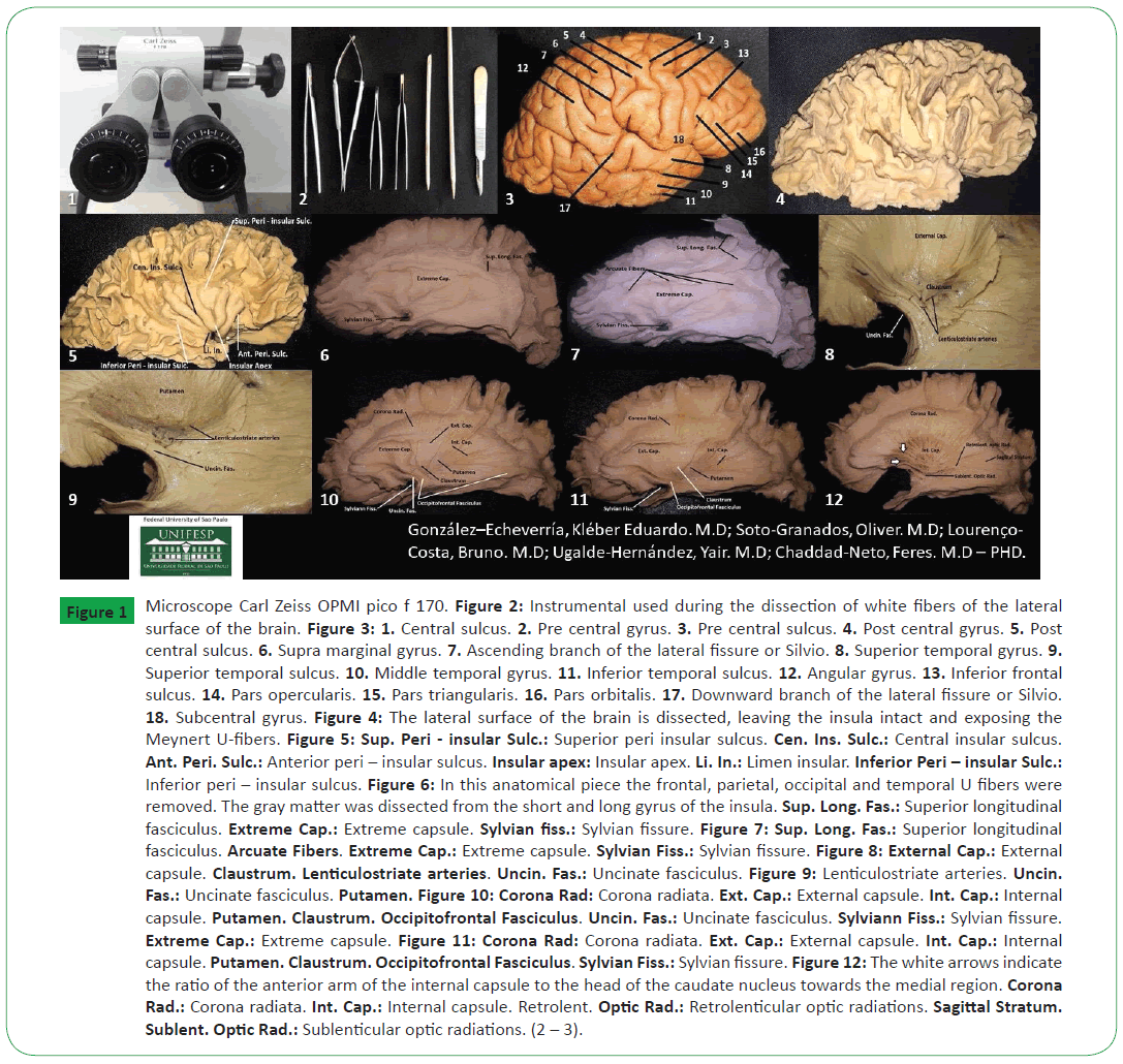 neurosciences-brain-imaging-Carl-Zeiss-OPMI