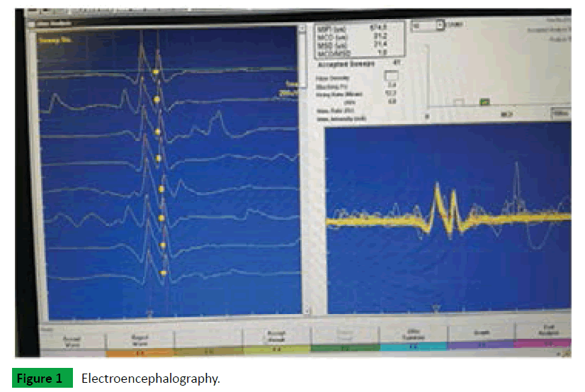 neurosciences-brain-imaging-Electroencephalography