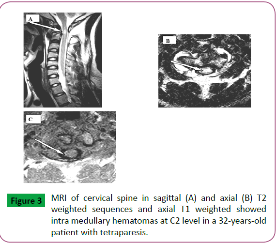 neurosciences-brain-imaging-cervical-spine