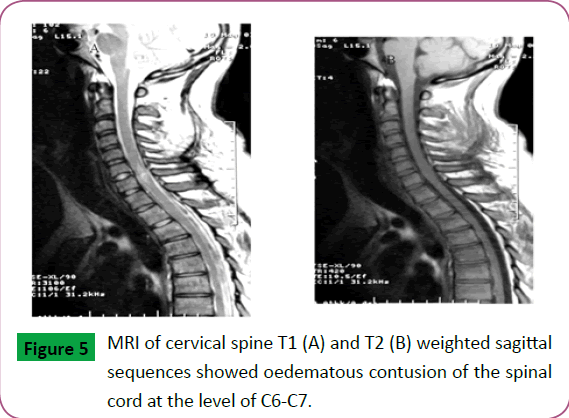 neurosciences-brain-imaging-cervical-spine